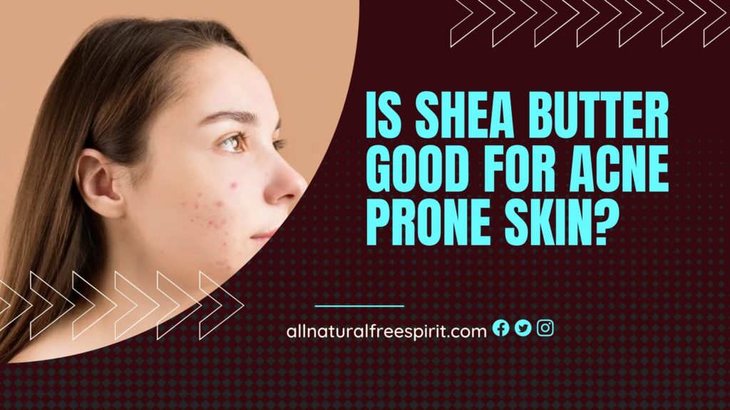 Is Shea Butter Good For Acne Prone Skin?