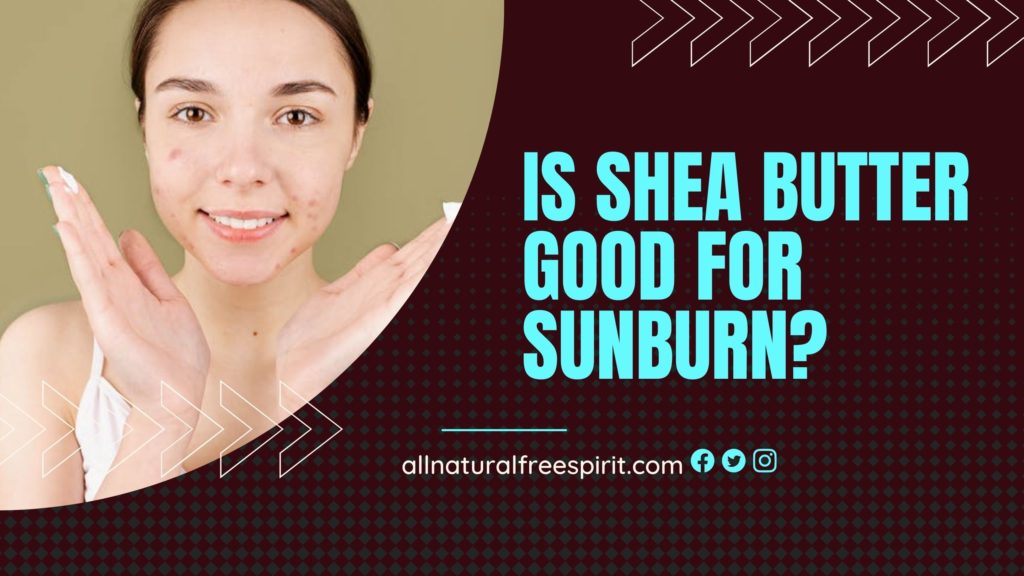 Is Shea Butter Good For Sunburn