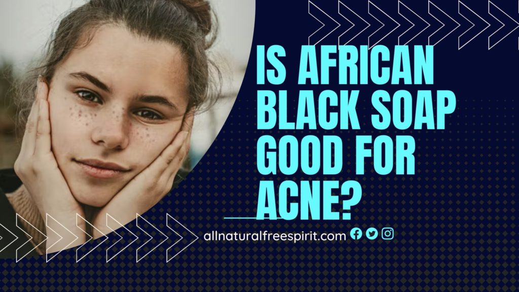 Is African Black Soap Good For Acne