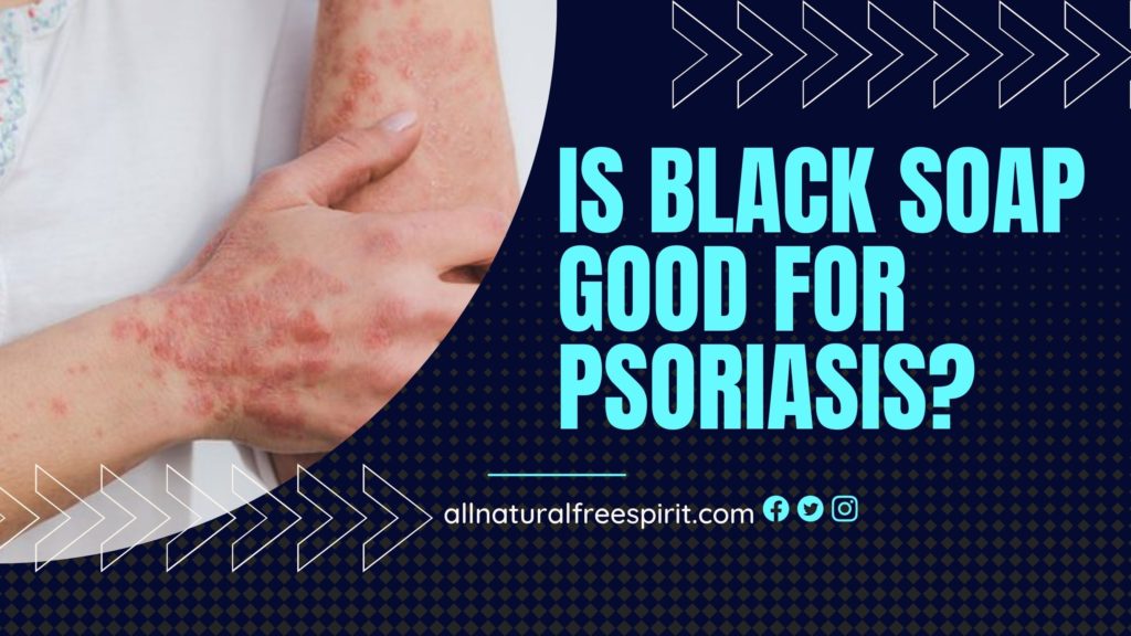 Is Black Soap Good For Psoriasis?